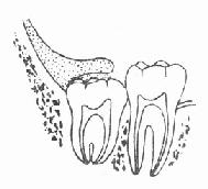 ���ܵ�ä��������֮����