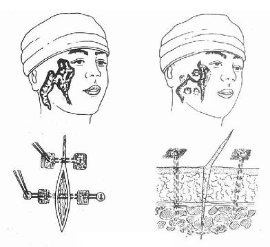 Ŧ����ʽ��Ϸ�