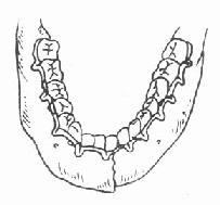 �ֶ�ʽ�����а�