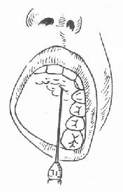 ������ע��