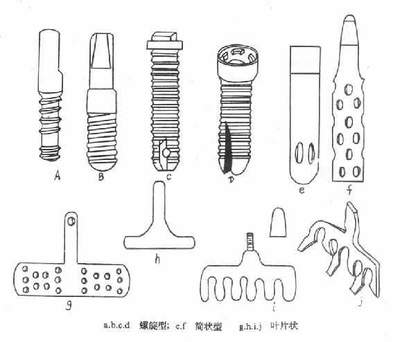 ������ֲ��