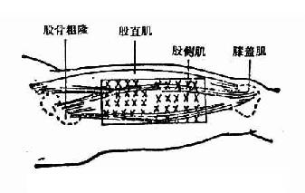 ����༡ע�䲿λ
