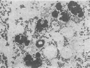 ��ϸ���ڴμ���ø��