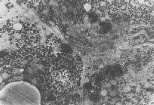 ��ϸ����֬���ؿ����д�С�弴��ĩ��ø��