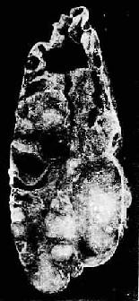 �ѳ�ճҺ������<a href=