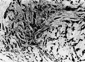 ����Ӳ<a href=