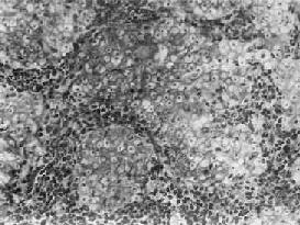 ������״��ϸ��<a href=