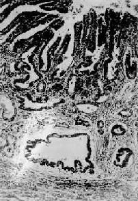 ����θ<a href=