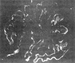 ����С�����Ĥ������