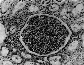 ������ëϸѪ������������С������