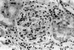 ������ϵĤ��������С������