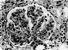 Ĥ����������С������