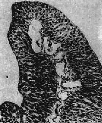 ��������ϸ��<a href=