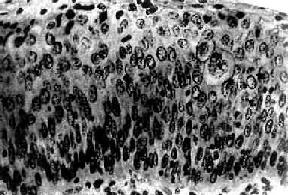 �ӹ���ԭλ<a href=