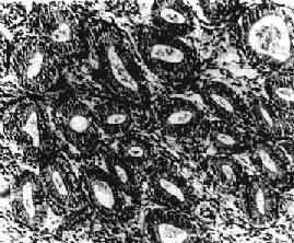 �ӹ���Ĥ����֢