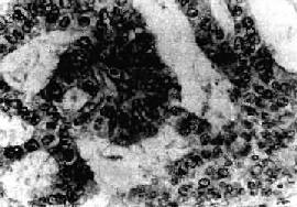 �ӹ���Ĥ��<a href=