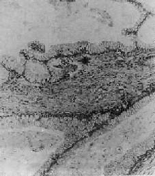 �ѳ�ճҺ������<a href=