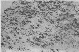 ��Ӧ�����ν���ϸ��������GFAPȾɫ��