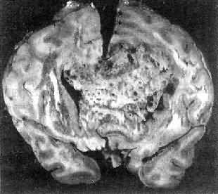 �����Խ���ĸϸ��<a href=