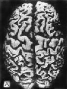 ������<a href=