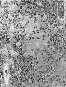 ����<a href=