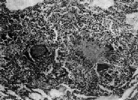 �������ѿ��