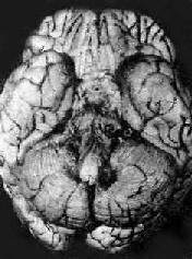 �������Ĥ��