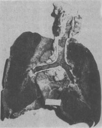 �����Է�<a href=