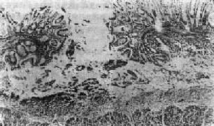 ���԰��װ�<a href=